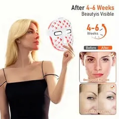 FACE MASK (FULL FACE LED LIGHT THERAPY MASK) - Image 2